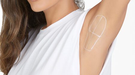 Hyperhidrosis Feature