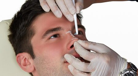 Dermal Fillers Head Shot