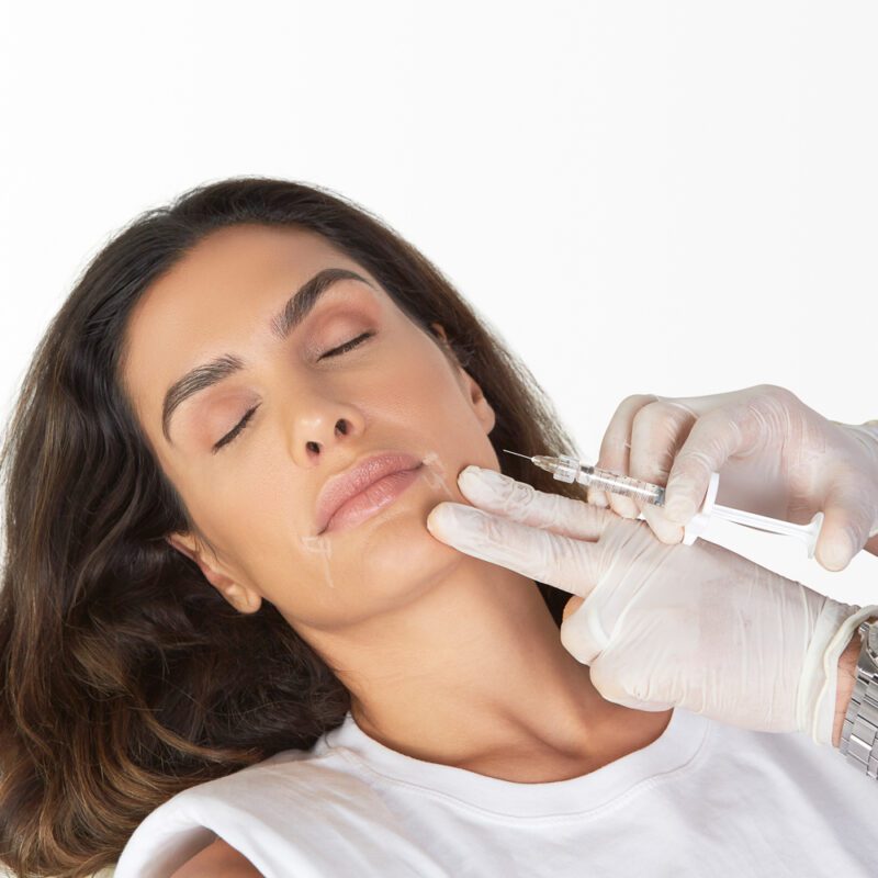 Marionette Lines Fillers