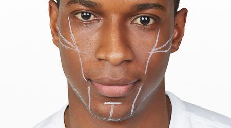 Chin and Jawline Augmentation Headshot