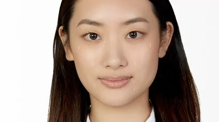 Profhilo Head Shot