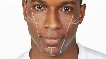 Chin and Jawline Augmentation Headshot